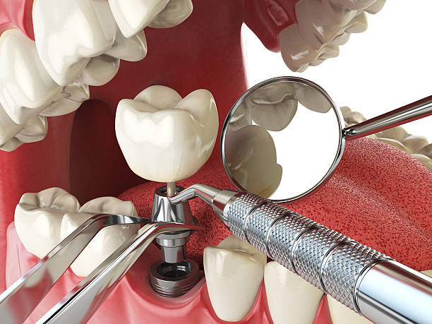 Best Cracked Tooth Emergency Dentist  in Emory, TX